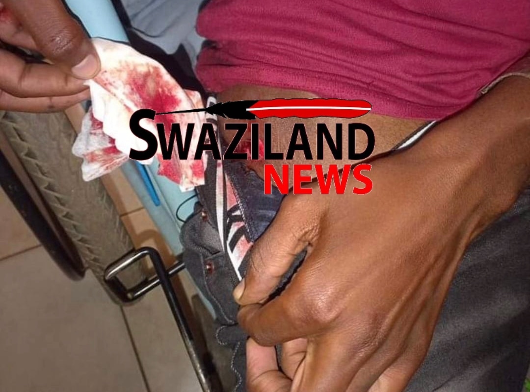 Two University students shot by Mswati’s police for protesting in demand for allowances.