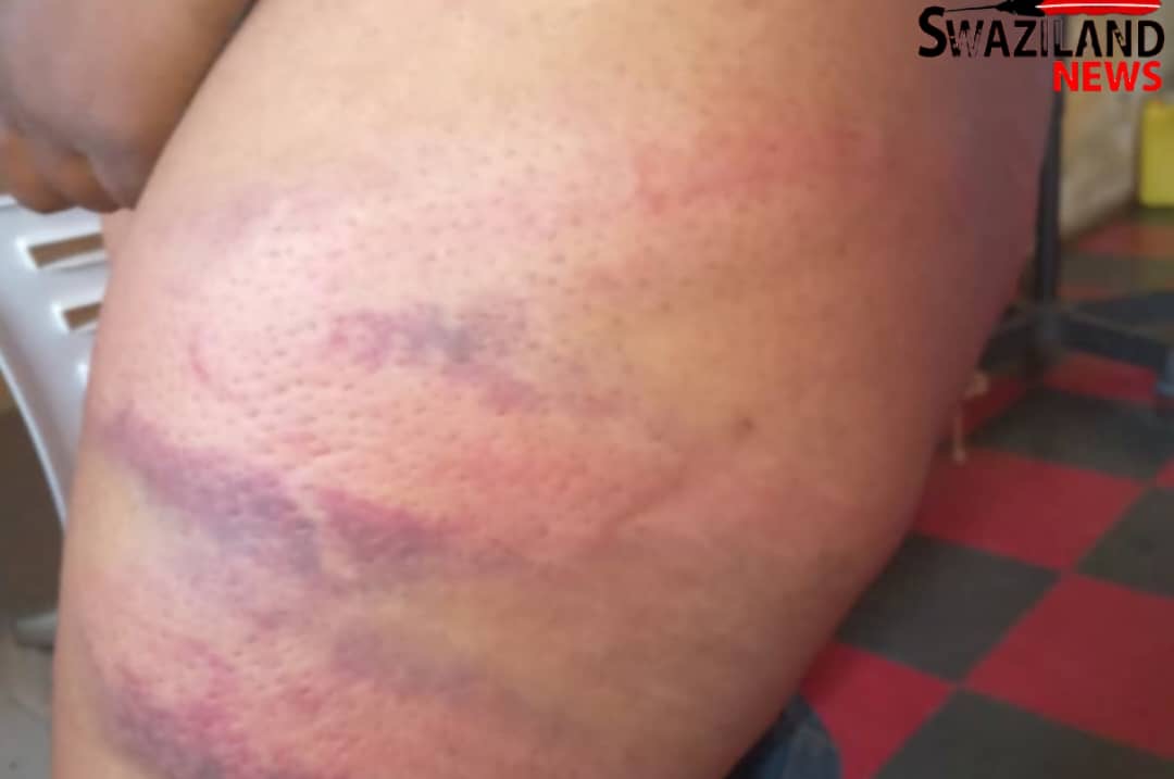 Manzini Police heavily assaults Lwandle residents including women for traveling at night, human rights violations under a culture of impunity rife in eSwatini.