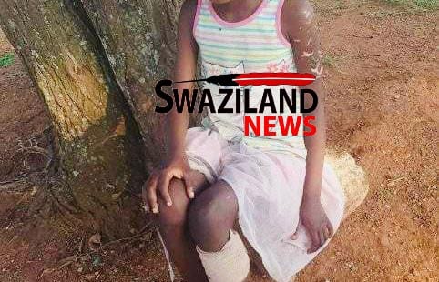 Fear at Mbikwakhe as stray dogs attack residents ‘eat’ children.