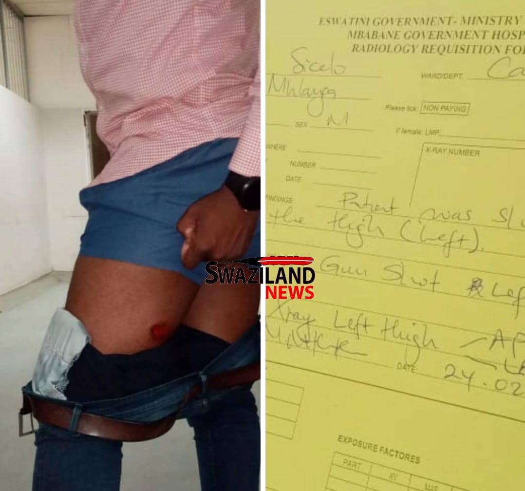 Police shot Democratic News journalist for covering protest at the High Court.