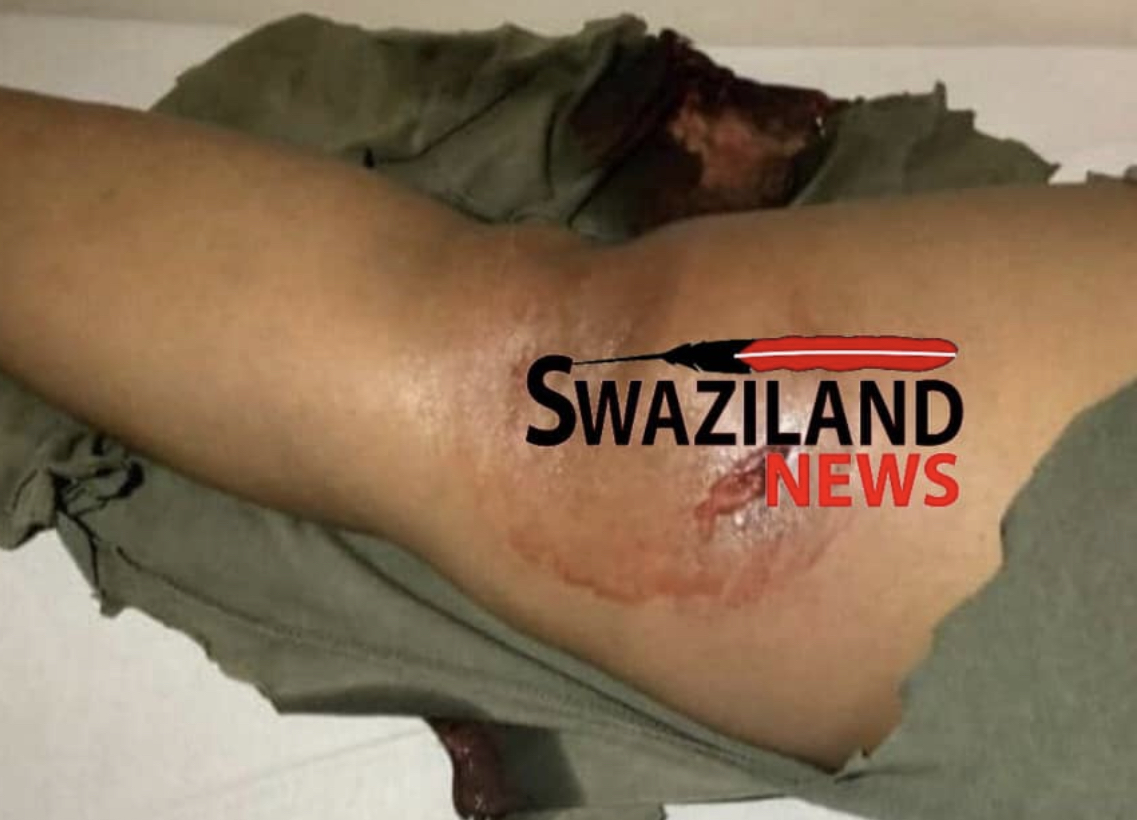 TENSION WITHIN FORCES: Soldier shoots two police officers at Mkhondvo Roadblock.