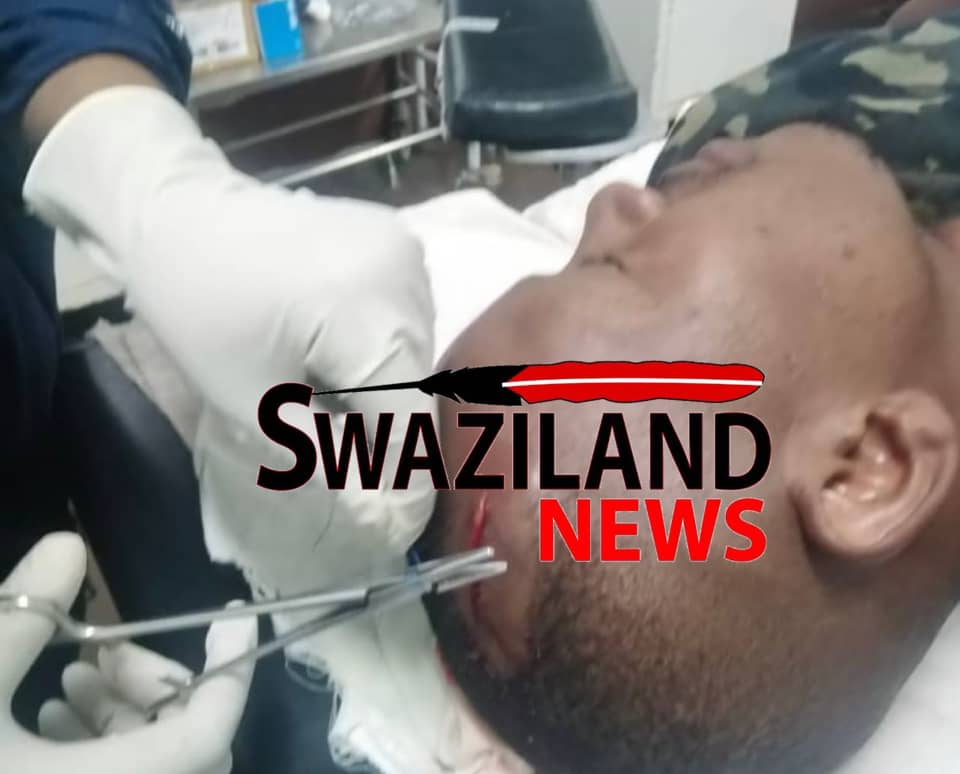 Abducted resigned pro-democracy cop ‘Meadowlands’ assaulted by OSSU police officers, rushed to hospital.