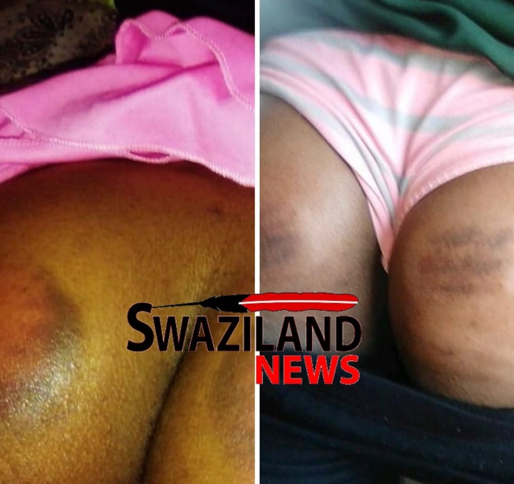 Ncabaneni High students rushed to hospital after being assaulted by Headteacher Dalton Kunene.