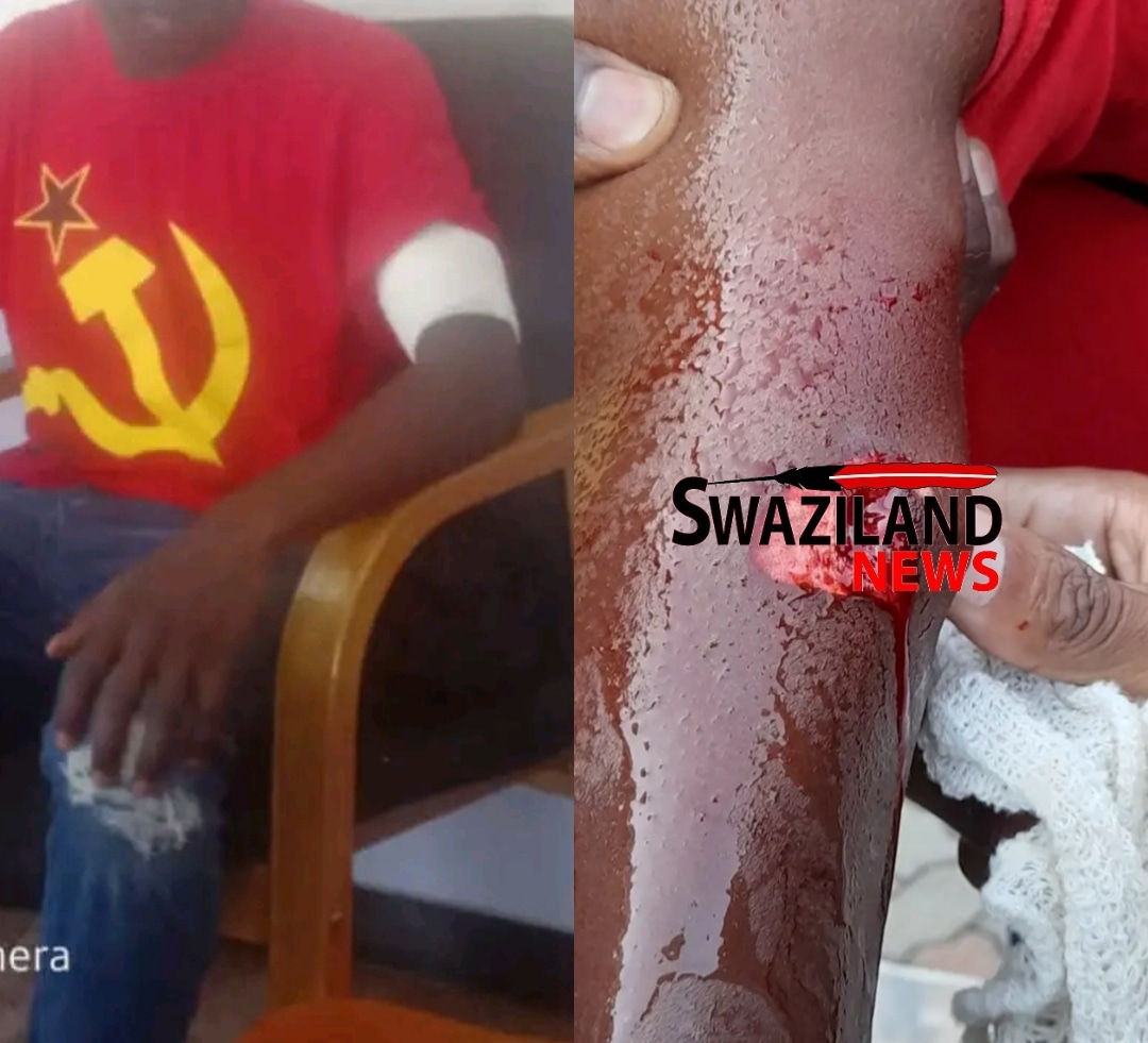 Communist Party member, Phiwangesihle Matse amongst among protestors shot by the police during Thabani Nkomonye’s commemoration.