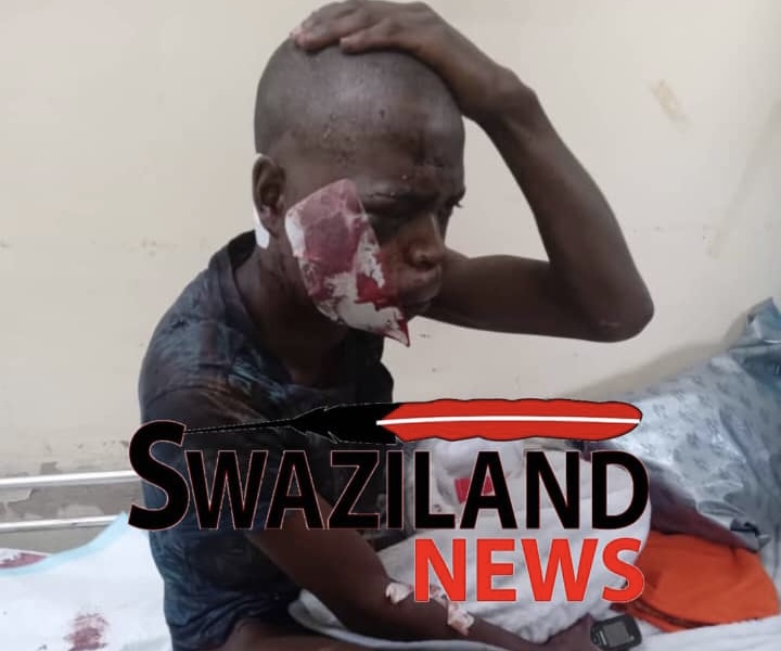 King Mswati’s mercenaries shoot epileptic and mentally-ill man during night patrols.
